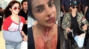 Bollywood stars Kangana Ranaut, Alia Bhatt, Priyanka Chopra Jonas, and others who had injuries on set